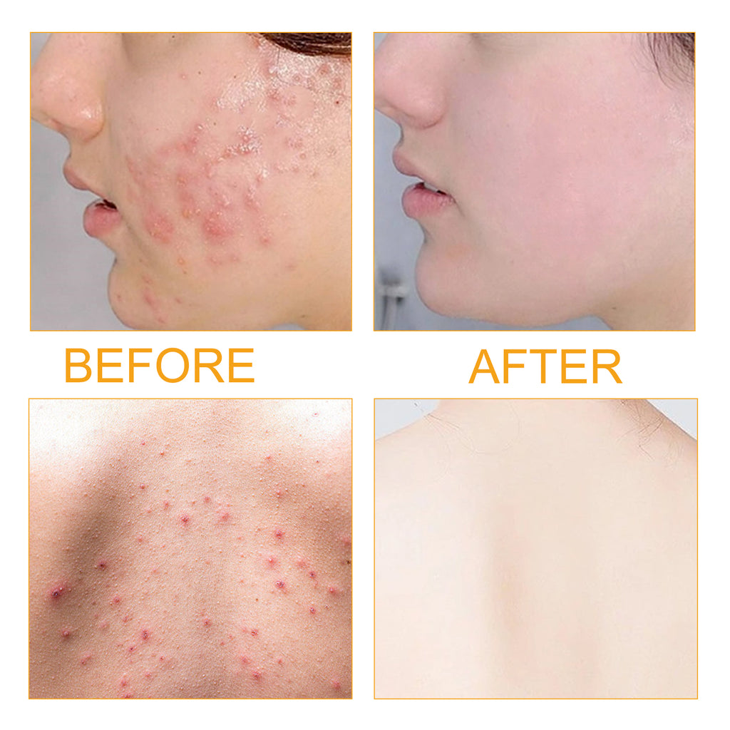 Collagen Peptide Clarifying & Repair Serum